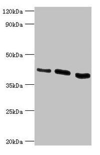 HTRA2 / OMI Antibody - Western blot All lanes: HTRA2 antibody at 0.9µg/ml Lane 1: Hela whole cell lysate Lane 2: U937 whole cell lysate Lane 3: 293T whole cell lysate Secondary Goat polyclonal to rabbit IgG at 1/10000 dilution Predicted band size: 49, 39, 47, 40 kDa Observed band size: 39 kDa