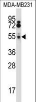 HTRA2 / OMI Antibody - HTRA2 Antibody western blot of MDA-MB231 cell line lysates (35 ug/lane). The HTRA2 antibody detected the HTRA2 protein (arrow).
