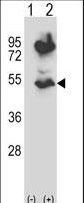 HTRA2 / OMI Antibody - Western blot of HTRA2 (arrow) using rabbit polyclonal HTRA2 Antibody. 293 cell lysates (2 ug/lane) either nontransfected (Lane 1) or transiently transfected (Lane 2) with the HTRA2 gene.