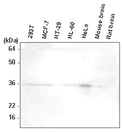HTRA2 / OMI Antibody - The extracts of 293T, MCF7, HT-29, HL-60, HeLa, mouse brain, and rat brain were resolved by SDS-PAGE, transferred to PVDF membrane and probed with anti-human HtrA2/Omi antibody (1:1000). Proteins were visualized using a goat anti-mouse secondary antibody conjugated to HRP and an ECL detection system.