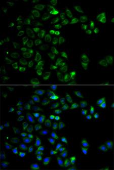 HTRA2 / OMI Antibody - Immunofluorescence analysis of HeLa cells.