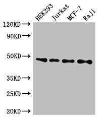 HTRA2 / OMI Antibody - Positive WB detected in:HEK293 whole cell lysate,Jurkat whole cell lysate,MCF-7 whole cell lysate,Raji whole cell lysate;All lanes:HTRA2 antibody at 3?g/ml;Secondary;Goat polyclonal to rabbit IgG at 1/50000 dilution;Predicted band size: 49,39,47,40 KDa;Observed band size: 49 KDa;