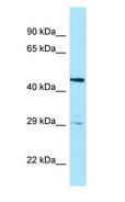 HTRA3 Antibody - HTRA3 antibody Western Blot of Fetal Brain.  This image was taken for the unconjugated form of this product. Other forms have not been tested.