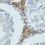 HTRA3 Antibody - Immunohistochemistry of paraffin-embedded rat testis using HTRA3 antibody at dilution of 1:100 (40x lens).