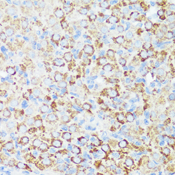 HTRA3 Antibody - Immunohistochemistry of paraffin-embedded rat ovary using HTRA3 antibody at dilution of 1:100 (40x lens).