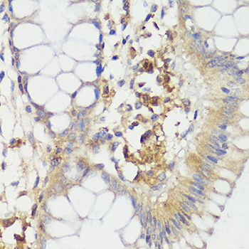 HTRA3 Antibody - Immunohistochemistry of paraffin-embedded human colon using HTRA3 antibody at dilution of 1:100 (40x lens).