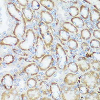 HTRA3 Antibody - Immunohistochemistry of paraffin-embedded mouse kidney using HTRA3 antibody at dilution of 1:100 (40x lens).