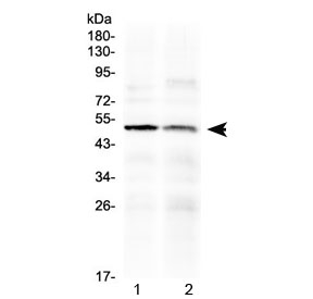 HTRA3 Antibody - Western blot testing of human 1) PANC1 and 2) HepG2 cell lysate with HtrA3 antibody at 0.5ug/ml. Predicted molecular weight ~49 kDa.