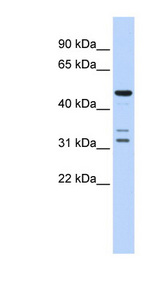 HTRA4 Antibody - HTRA4 antibody Western blot of Fetal Brain lysate. This image was taken for the unconjugated form of this product. Other forms have not been tested.