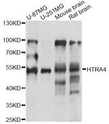 HTRA4 Antibody - Western blot analysis of extracts of various cell lines, using HTRA4 antibody at 1:1000 dilution. The secondary antibody used was an HRP Goat Anti-Rabbit IgG (H+L) at 1:10000 dilution. Lysates were loaded 25ug per lane and 3% nonfat dry milk in TBST was used for blocking. An ECL Kit was used for detection and the exposure time was 90s.