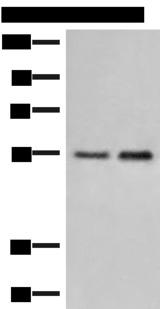 HTRA4 Antibody - Western blot analysis of Human placenta tissue and 231 cell lysates  using HTRA4 Polyclonal Antibody at dilution of 1:400
