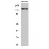 HTS1 / ST5 Antibody - Western blot of ST5 antibody