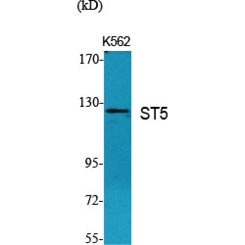 HTS1 / ST5 Antibody - Western blot of ST5 antibody