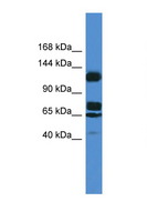 HTS1 / ST5 Antibody - ST5 antibody Western blot of 721_B Cell lysate. Antibody concentration 1 ug/ml.  This image was taken for the unconjugated form of this product. Other forms have not been tested.