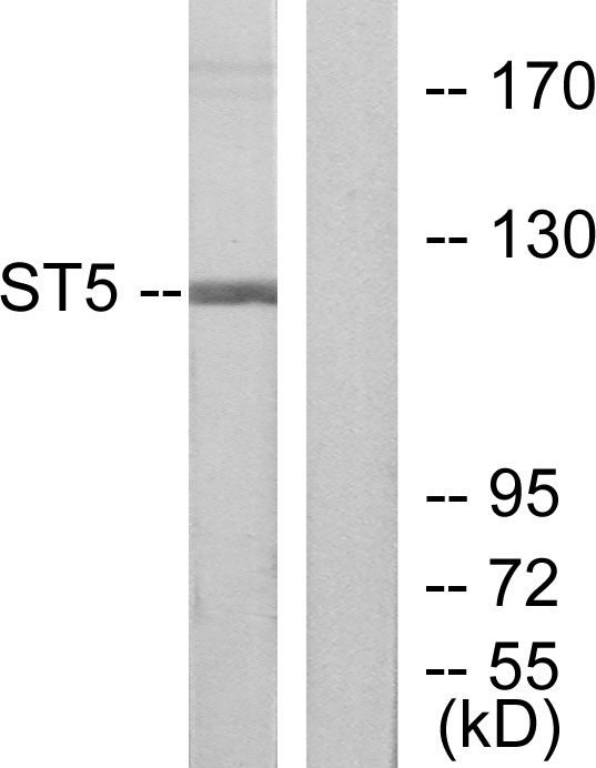 HTS1 / ST5 Antibody - Western blot analysis of lysates from COLO205 cells, using ST5 Antibody. The lane on the right is blocked with the synthesized peptide.