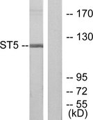 HTS1 / ST5 Antibody - Western blot analysis of lysates from COLO205 cells, using ST5 Antibody. The lane on the right is blocked with the synthesized peptide.