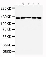 HTS1 / ST5 Antibody - WB of HTS1 / ST5 antibody. All lanes: Anti-ST5 at 0.5ug/ml. Lane 1: Rat Testis Tissue Lysate at 40ug. Lane 2: A431 Whole Cell Lysate at 40ug. Lane 3: HELA Whole Cell Lysate at 40ug. Lane 4: COLO320 Whole Cell Lysate at 40ug. Lane 5: NIH Whole Cell Lysate at 40ug. Predicted bind size: 126KD. Observed bind size: 126KD.
