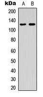 HTS1 / ST5 Antibody - Western blot analysis of ST5 expression in K562 (A); human spleen (B) whole cell lysates.