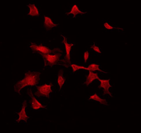 HTS1 / ST5 Antibody - Staining COLO205 cells by IF/ICC. The samples were fixed with PFA and permeabilized in 0.1% Triton X-100, then blocked in 10% serum for 45 min at 25°C. The primary antibody was diluted at 1:200 and incubated with the sample for 1 hour at 37°C. An Alexa Fluor 594 conjugated goat anti-rabbit IgG (H+L) Ab, diluted at 1/600, was used as the secondary antibody.