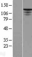 HTS1 / ST5 Protein - Western validation with an anti-DDK antibody * L: Control HEK293 lysate R: Over-expression lysate