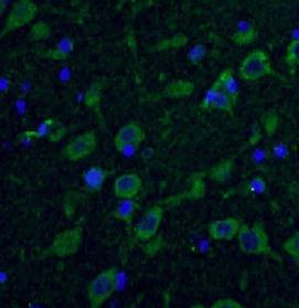 HTT / Huntingtin Antibody - Immunofluorescent analysis of (4% PFA) fixed human brain tissue using Huntingtin antibody at dilution of 1:50 and Alexa Fluor 488-congugated Goat Anti-Rabbit IgG(H+L)