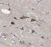 HTT / Huntingtin Antibody - Immunohistochemistry of paraffin-embedded rat brain tissue slide using Huntingtin antibody at dilution of 1:200