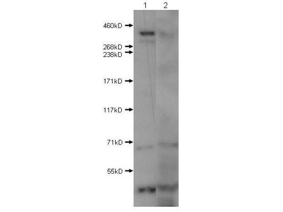HTT / Huntingtin Antibody - Western Blot of Rabbit Anti-Huntington antibody. Lane 1: mouse brain extract absence of blocking peptide. Lane 2: mouse brain extract with blocking peptide. Load: 10 µg per lane. Primary antibody: Huntington antibody at 0.1µg/mL for overnight at 4°C. Secondary antibody: IRDye800™ rabbit secondary antibody at 1:10,000 for 45 min at RT.