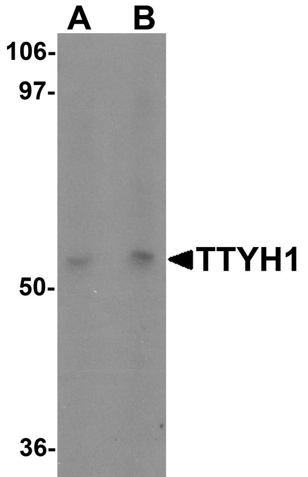 HTTY1 / TTYH1 Antibody - Western blot analysis of TTYH1 in Raji cell lysate with TTYH1 antibody at (A) 1 and (B) 2 ug/ml.