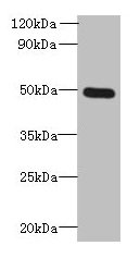 HTTY1 / TTYH1 Antibody - Western blot All lanes: TTYH1 antibody at 4µg/ml + Raji whole cell lysate Secondary Goat polyclonal to rabbit IgG at 1/10000 dilution Predicted band size: 50, 27, 36 kDa Observed band size: 50 kDa
