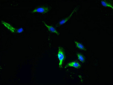 HTTY1 / TTYH1 Antibody - Immunofluorescent analysis of Hela cells using TTYH1 Antibody at dilution of 1:100 and Alexa Fluor 488-congugated AffiniPure Goat Anti-Rabbit IgG(H+L)