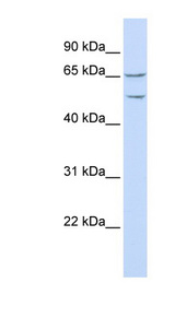HTTY1 / TTYH1 Antibody - TTYH1 antibody Western blot of HeLa lysate. This image was taken for the unconjugated form of this product. Other forms have not been tested.