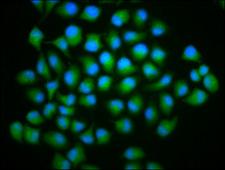 HTYW5 / C2orf60 Antibody - Immunofluorescence staining of Hela cells diluted at 1:166, counter-stained with DAPI. The cells were fixed in 4% formaldehyde, permeabilized using 0.2% Triton X-100 and blocked in 10% normal Goat Serum. The cells were then incubated with the antibody overnight at 4°C.The Secondary antibody was Alexa Fluor 488-congugated AffiniPure Goat Anti-Rabbit IgG (H+L).