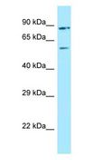 HUFI-2 / LRRFIP2 Antibody - HUFI-2 / LRRFIP2 antibody Western Blot of 721_B.  This image was taken for the unconjugated form of this product. Other forms have not been tested.