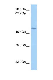 HUFI-2 / LRRFIP2 Antibody - LRRFIP2 antibody Western blot of Jurkat Cell lysate. Antibody concentration 1 ug/ml.  This image was taken for the unconjugated form of this product. Other forms have not been tested.