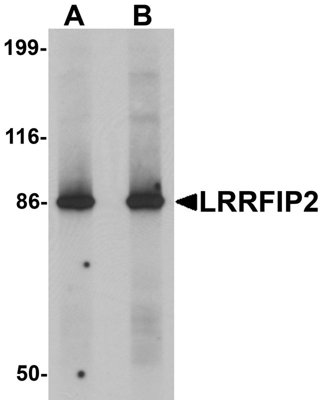 HUFI-2 / LRRFIP2 Antibody - Western blot analysis of LRRFIP2 in rat colon tissue lysate with LRRFIP2 antibody at (A) 0.5 and (B) 1 ug/ml.