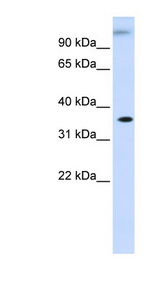 HUM2DD / DHDH Antibody - DHDH antibody Western blot of Fetal Liver lysate. This image was taken for the unconjugated form of this product. Other forms have not been tested.