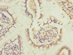 HUM2DD / DHDH Antibody - Immunohistochemistry of paraffin-embedded human small intestine at dilution 1:100