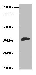 HUM2DD / DHDH Antibody - Western blot All Lanes:DHDH antibody at 1.4ug/ml+mouse liver tissue Secondary Goat polyclonal to rabbit at 1/10000 dilution Predicted band size: 36kDa Observed band size: 36kDa