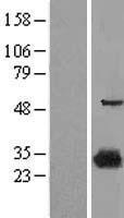 15-PGDH / HPGD Protein - Western validation with an anti-DDK antibody * L: Control HEK293 lysate R: Over-expression lysate