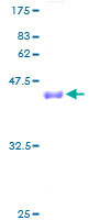4E-BP2 / EIF4EBP2 Protein - 12.5% SDS-PAGE of human EIF4EBP2 stained with Coomassie Blue