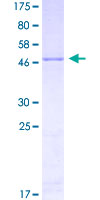 5-Alpha Reductase / SRD5A1 Protein - 12.5% SDS-PAGE of human SRD5A1 stained with Coomassie Blue