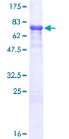 A1BG Protein - 12.5% SDS-PAGE of human A1BG stained with Coomassie Blue