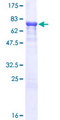 A1BG Protein - 12.5% SDS-PAGE of human A1BG stained with Coomassie Blue