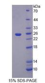 A1BG Protein - Recombinant Alpha-1-B-Glycoprotein By SDS-PAGE