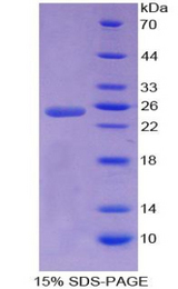 A1CF / ACF Protein - Recombinant Apobec 1 Complementation Factor By SDS-PAGE