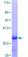A2M / Alpha-2-Macroglobulin Protein - 12.5% SDS-PAGE Stained with Coomassie Blue.