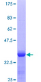 A2M / Alpha-2-Macroglobulin Protein - 12.5% SDS-PAGE Stained with Coomassie Blue.