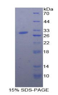 A2ML1 Protein - Recombinant Alpha-2-Microglobulin Like Protein 1 By SDS-PAGE