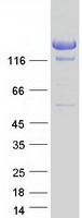 A2ML1 Protein - Purified recombinant protein A2ML1 was analyzed by SDS-PAGE gel and Coomassie Blue Staining