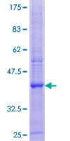 A4 / PLP2 Protein - 12.5% SDS-PAGE of human PLP2 stained with Coomassie Blue